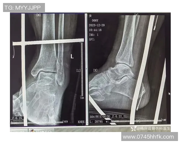 加兰左脚大脚趾再度受伤复查结果将影响未来比赛安排